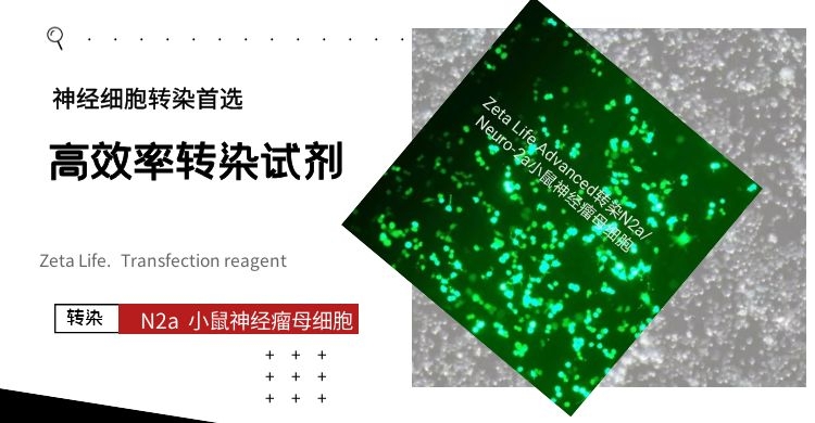 N2a转染试剂.jpg